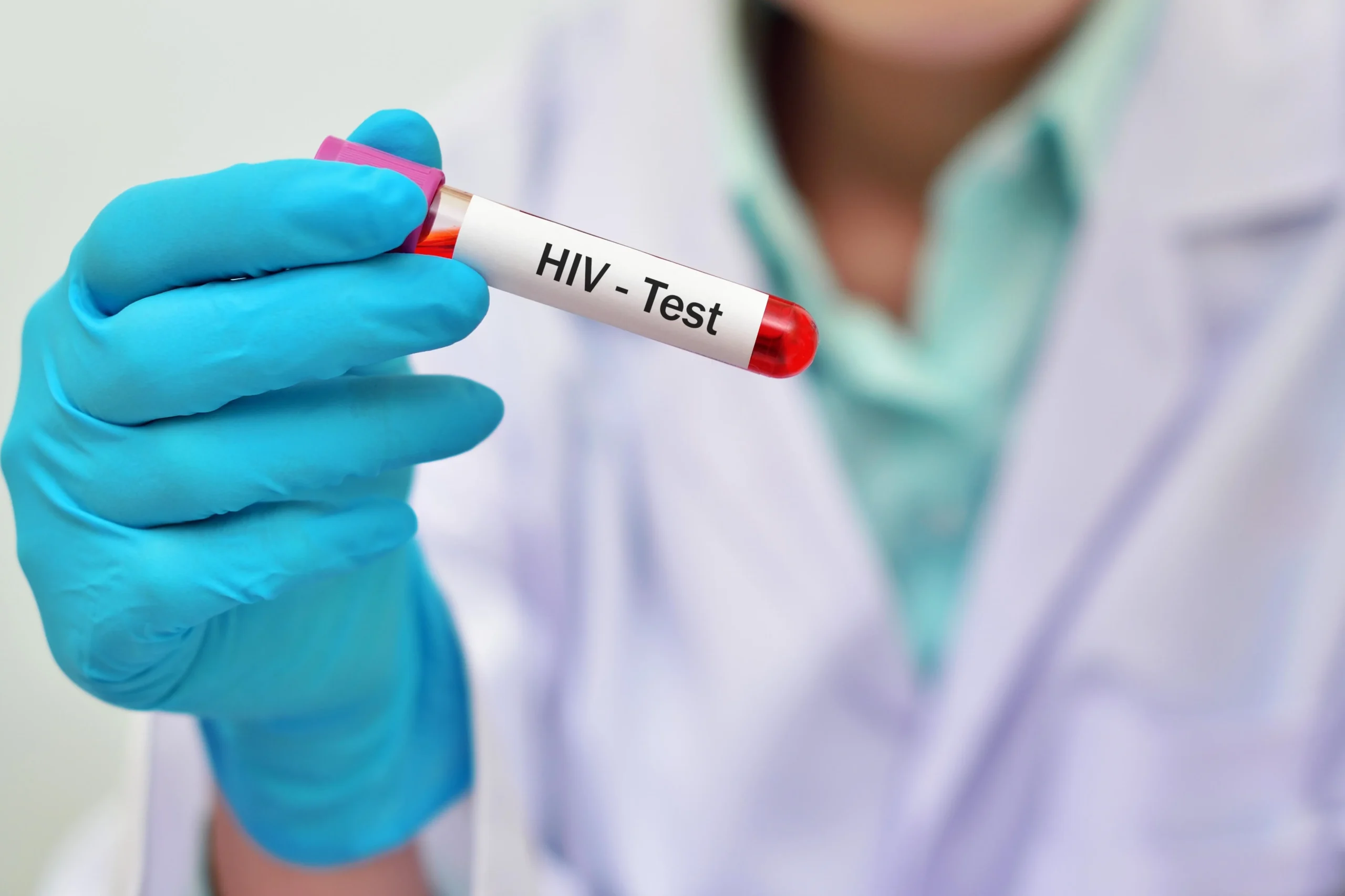 An online PrEP provider holding a blood sample tube for testing before issuing a PrEP online prescription.